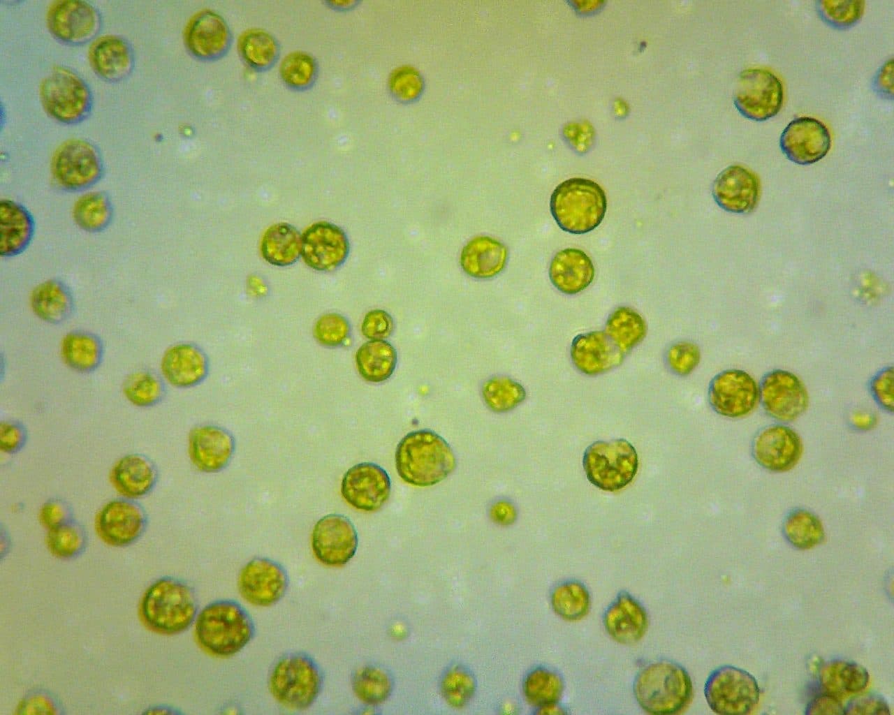Live *Crypthecodinium cohnii* at 400× magnification. The rounded, golden dinoflagellate cells are dense with lipids, including high concentrations of DHA.