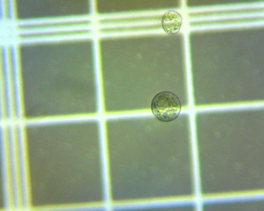*C. cohnii* strain CR30556. The rounded, golden dinoflagellate cells are readily distinguished from the smaller, oval *Tetraselmis* cells shown below.