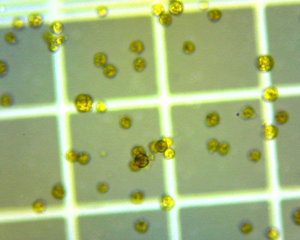 Cells counted against a hemocytometer grid — the method used to track culture density every 24 hours.
